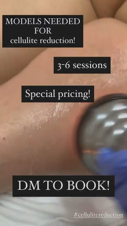 Sol Aesthetics By Anaiz - Cellulite reduction - Skin Care Near Me - Chandler, Arizona