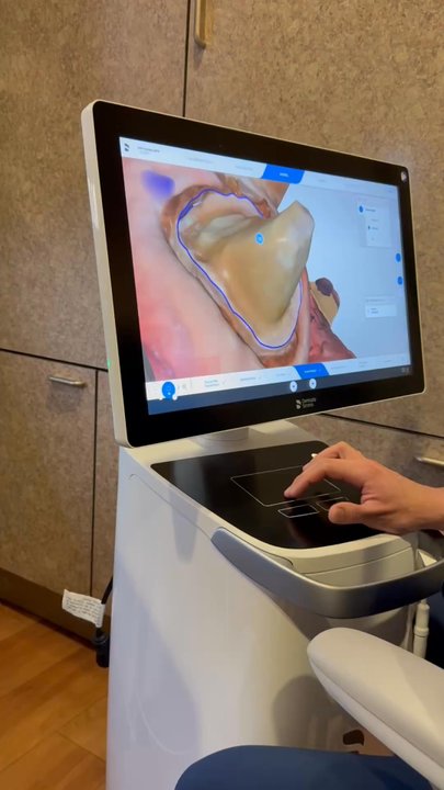 Alan J White, DDS - Designing my crown while I watch - General Dentistry Near Me - Staunton, Virginia