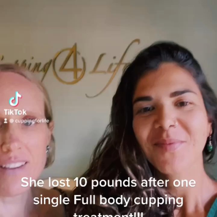 Cupping4Life - She lost 10 post ( water retention) after one single treatment of Full Body Cupping Detox Treatment. - Massage Near Me - San Diego, California