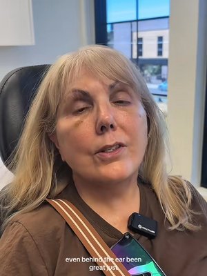 Blepharoplasty result at Utah Facial Plastics & UFP Hair Restoration