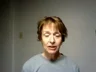 Lisa, about 72 hours after belt lipectomy