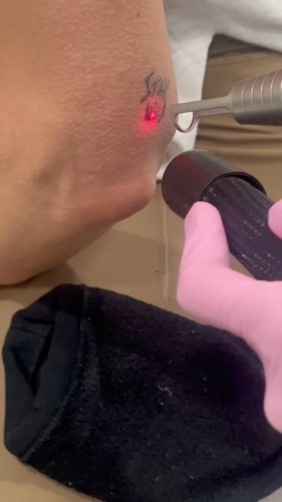 dr LASER - DO NOT BOOK HERE!! I came here for a tattoo removal and saw no frosting, no redness, no breakdown. I have called and emailed- no response - Medical Spas Near Me - New York, New York