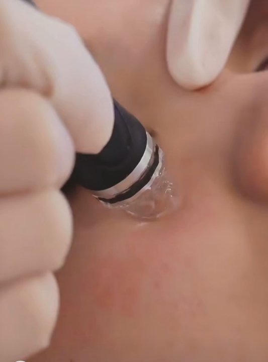 Aesthe MedSpa - Great experience - Skin Care Near Me - Stamford, Connecticut
