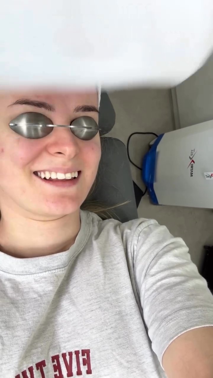 Azemine Mula — Treatment Review at Seoul SY Dermatology