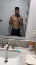 @fitkanaks, day 15 after gynecomastia surgery