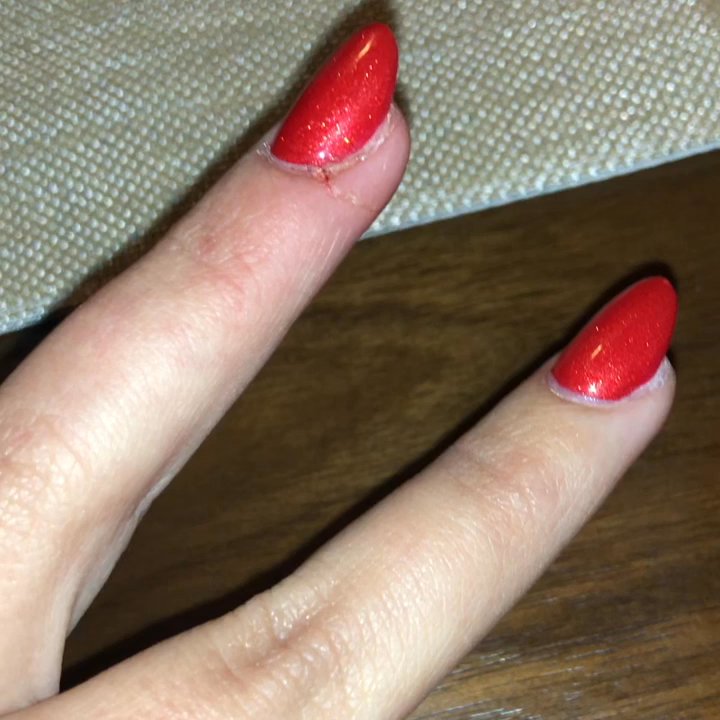 Bella Nail Bar - It's pretty bad and goes all the way around to the underside of my finger. - Waxing Near Me - Everett, Washington