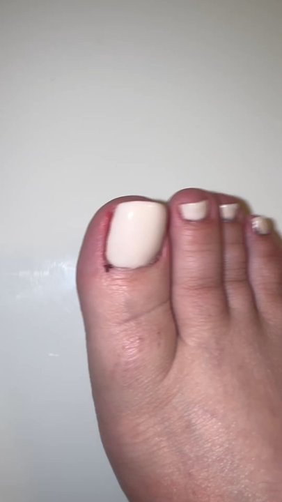 Q Nails Two - This was the result afterwards. My toes hurt. - Nail Salons Near Me - Norwalk, Connecticut