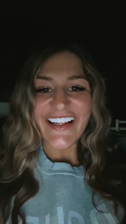 The Smiling Face - Absolutely in love with my Composite Veneers by Ebony at The Smiling Face and Co! - Teeth Whitening Near Me - Raleigh, North Carolina