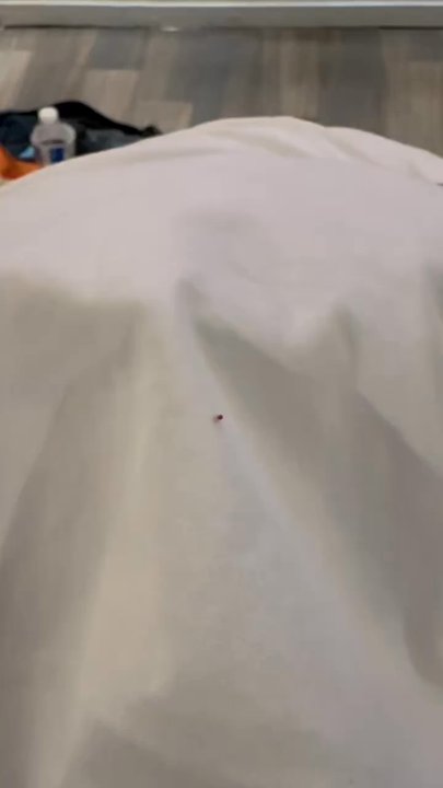 Big Texan Motel - The second adult bedbug we found on our bed. - Hotels Near Me - Amarillo, Texas