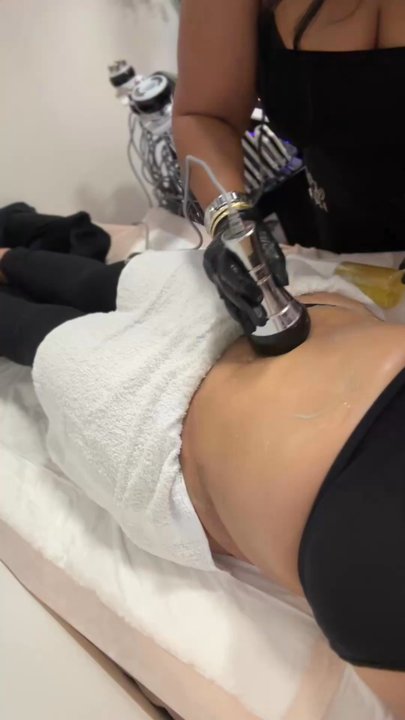 Beyou Bodycontour - Cavitation - Skin Care Near Me - Long Beach, California