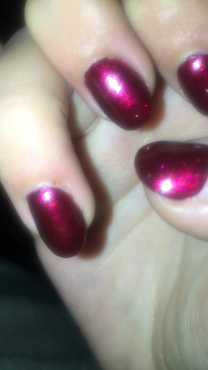 CK Nails - You can see one of the lacerations. There's more on the other hand :( - Nail Salons Near Me - Columbus, Ohio