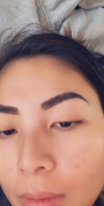 My Mai Brows - What the scabbing process looks like. Super itchy! But don't touch it! - Eyebrow Services Near Me - San Jose, California