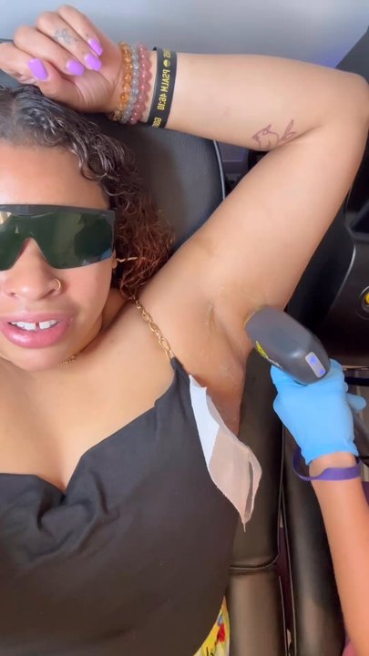 Soft Touch Laser Hair Removal - Laser Hair Removal Near Me - Oldsmar, Florida