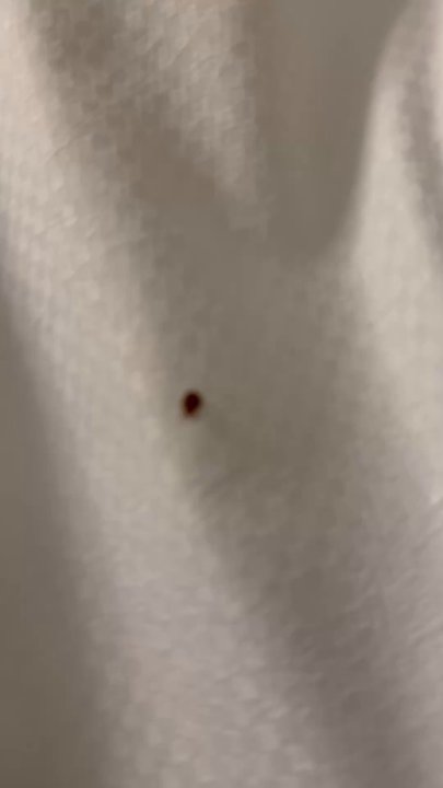 Mohegan Sun - Bedbug crawling on my sheets - Hotels Near Me - Uncasville, Connecticut