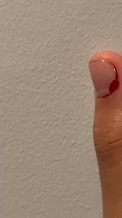 Honey Nails Salon - Thumb kept bleeding while the other one was red from pressing to stop the bleeding. - Nail Salons Near Me - Brooklyn, New York
