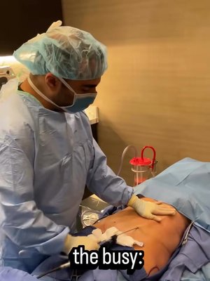 Mommy Makeover result at Ourian Plastic Surgery