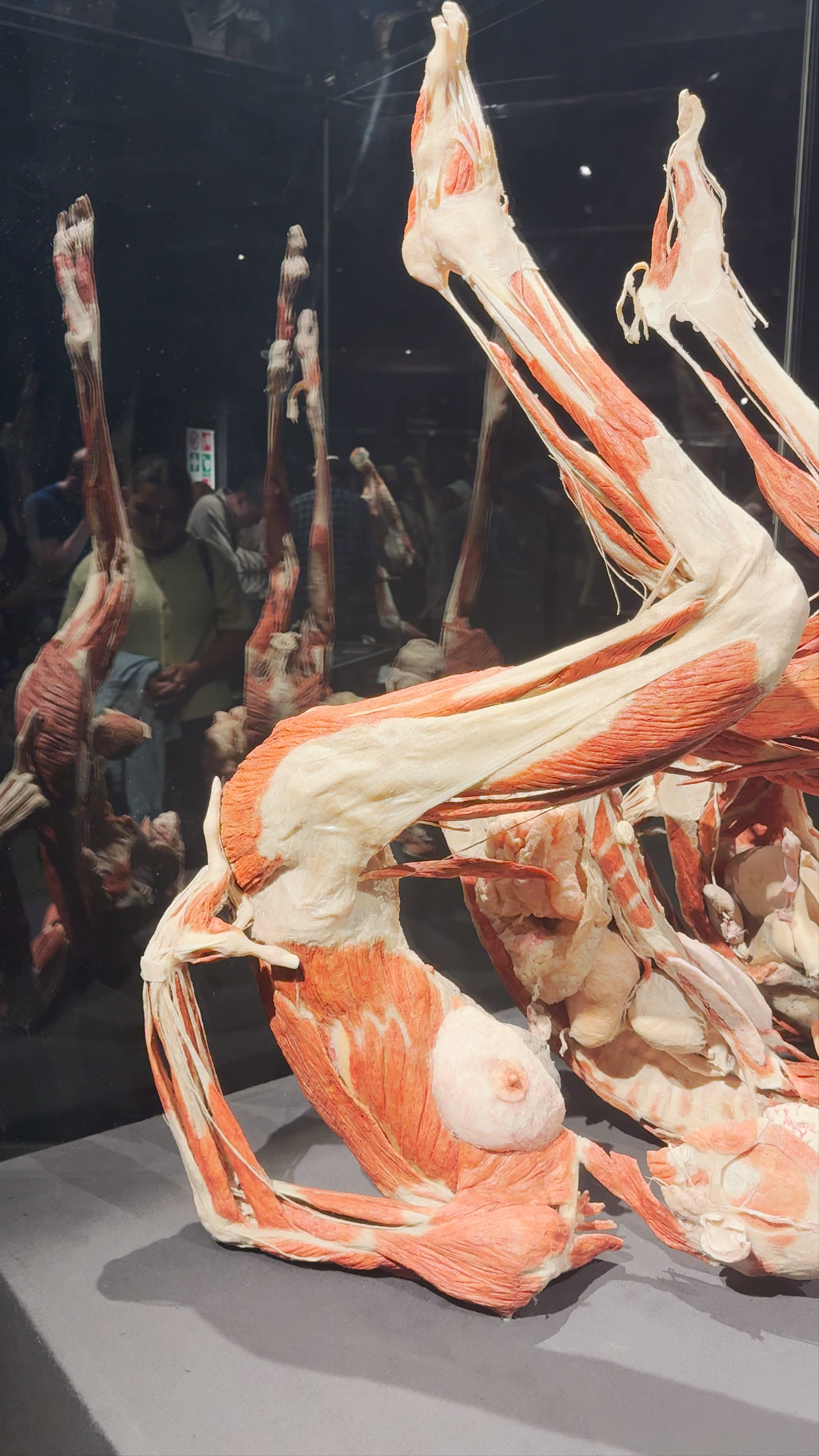 Body Worlds