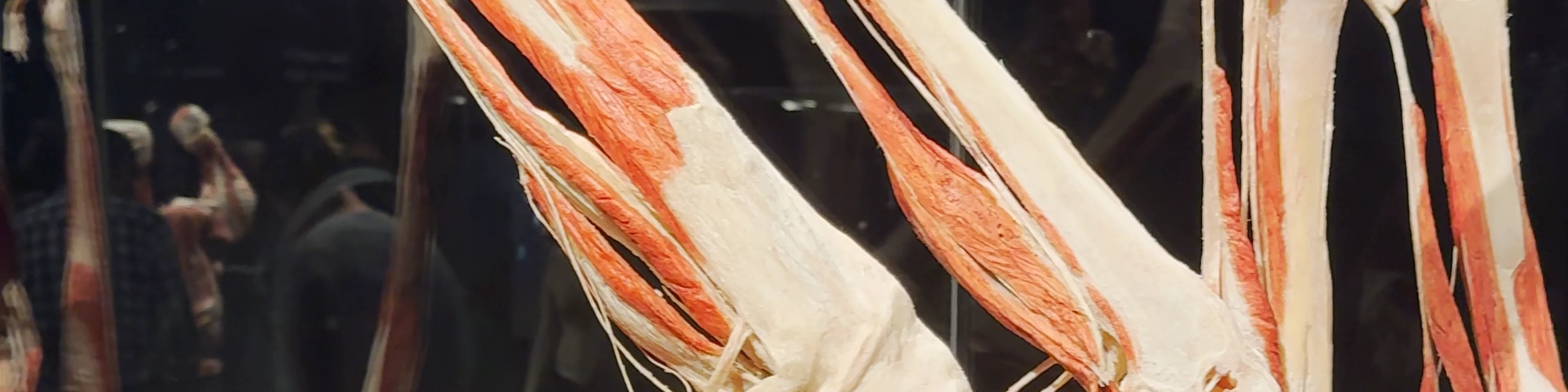Body Worlds