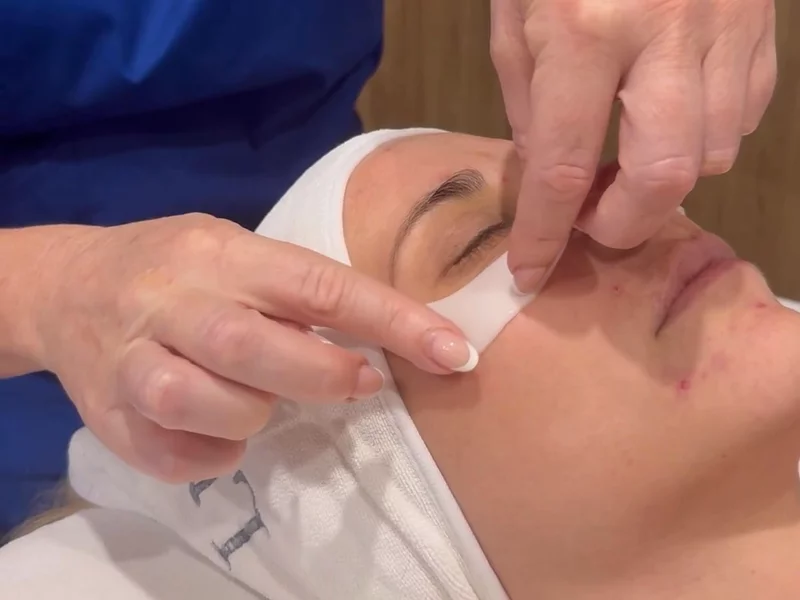 Intraceuticals - Oxygen Facial