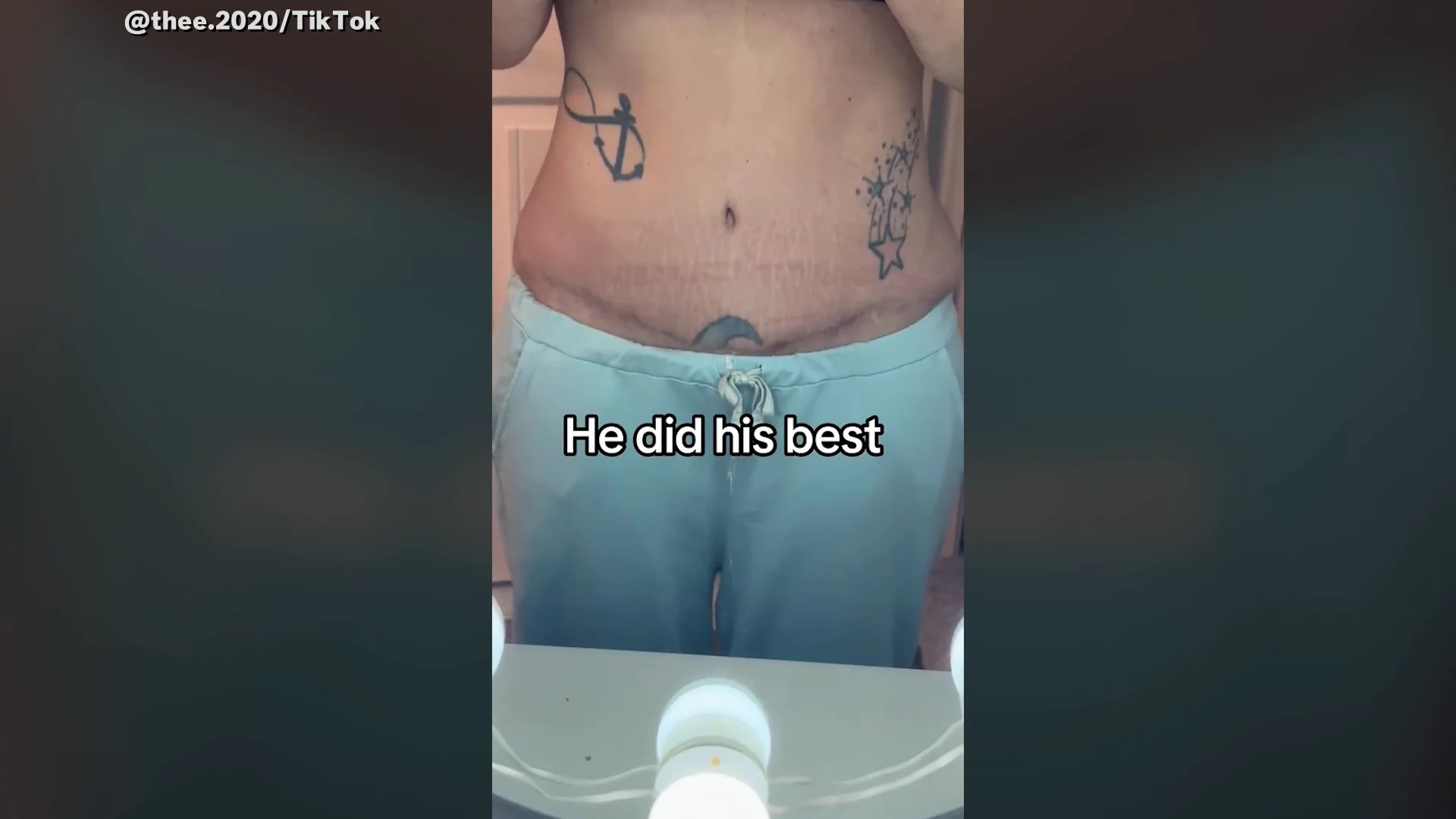 Woman With Belly Button Tattoo Gets Tummy Tuck, Here's Where It Ends Up -  Newsweek, image size:1920x1080