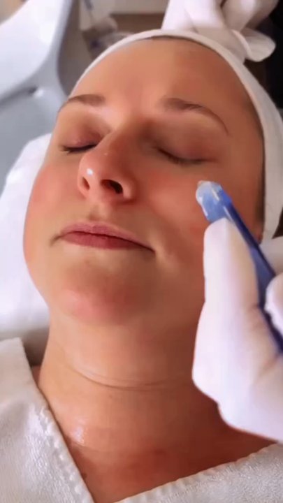 Princeton Aesthetics - Embrace the Process of Aging Gracefully! JetPeel treatment, can turn back the clock and unveil a more youthful! - Medical Spas Near Me - Princeton Junction, New Jersey