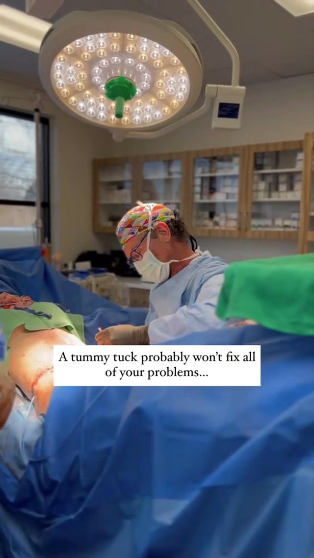 Tummy Tuck result at The Rose Clinic