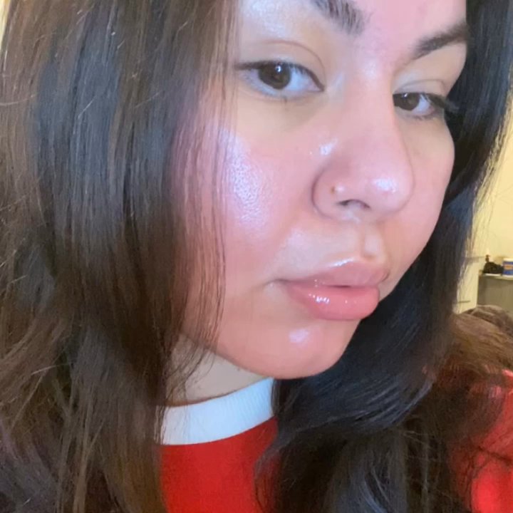 BosBeauty - 2month Healed Lip Filler - Skin Care Near Me - Las Vegas, Nevada