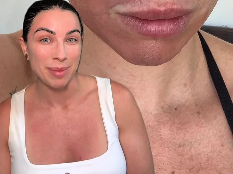 Skincare Problem Solution