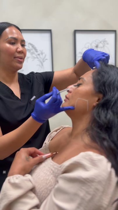 NaturalGlo Aesthetics - 11's and she also has my masseters outlined. Master Botox has a functional benefit for people that grind their teeth. - Medical Spas Near Me - Temecula, California