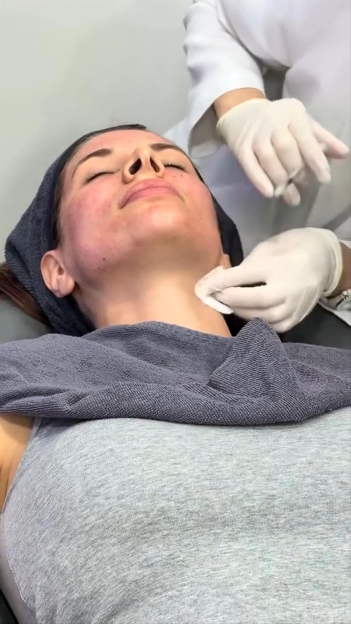 Marina Orekhova — Treatment Review at Seoul SY Dermatology