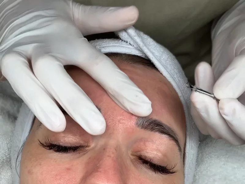 SkinCare Treatment Review