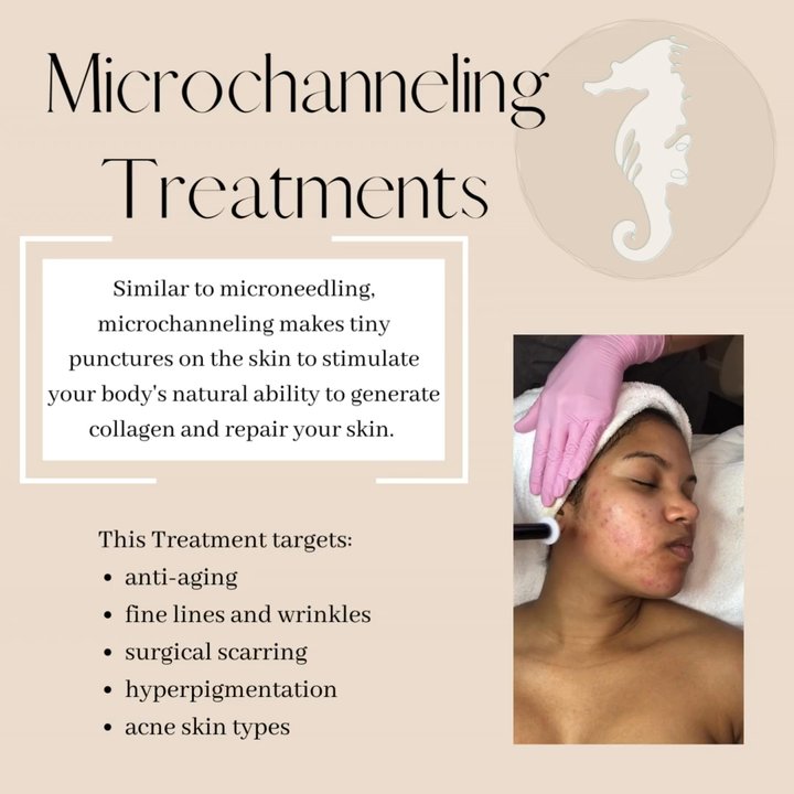 Charlotte Sugaring - microchanneling treatments - Skin Care Near Me - Matthews, North Carolina