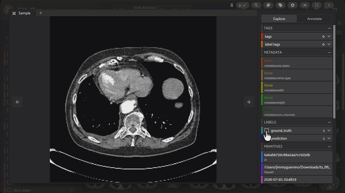 FiftyOne grid of CT failures spread across anatomy and patients via diversity-aware sorting for smarter re-annotation.