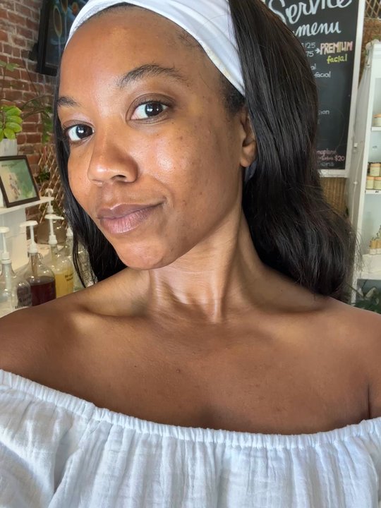 All Love Collections - Post facial glow - Skin Care Near Me - Pasadena, California