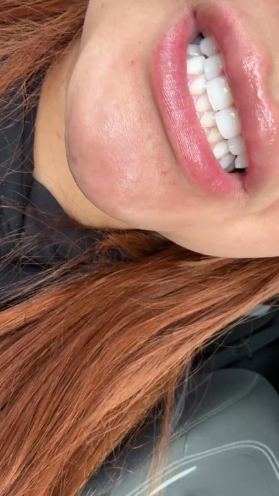 Fairywhite Teeth Whitening - Teeth Whitening Near Me - Artesia, California