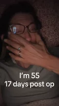 @unfilteredjennifer on four procedures