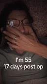 @unfilteredjennifer on four procedures