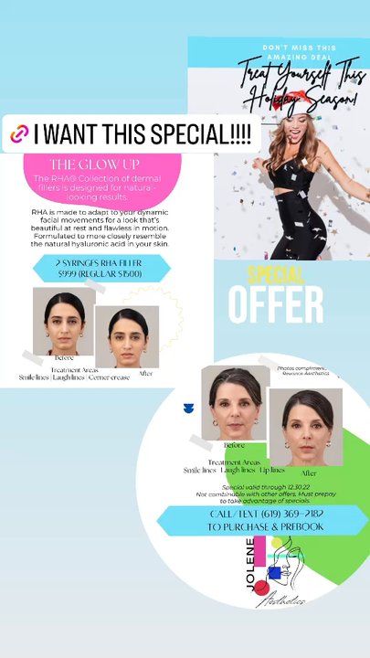 Jolene Aesthetics - December specials - Medical Spas Near Me - Carlsbad, California