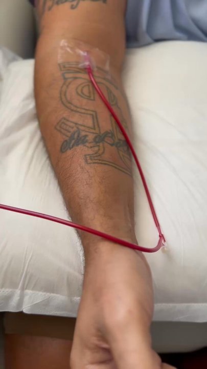 Centner Wellness - The bright blood is returning into my body after running through a filter and receiving UV treatments. The darker blood is full of toxins. - IV Hydration Near Me - Miami, Florida
