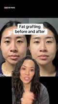 @drmonicakieu’s one-month case discussion