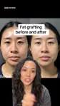 @drmonicakieu’s one-month case discussion