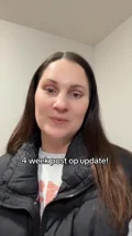 @sabrinaaa0830, four weeks after an endoscopic brow lift with upper eyelid surgery
