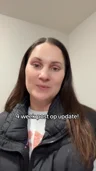 @sabrinaaa0830, four weeks after an endoscopic brow lift with upper eyelid surgery