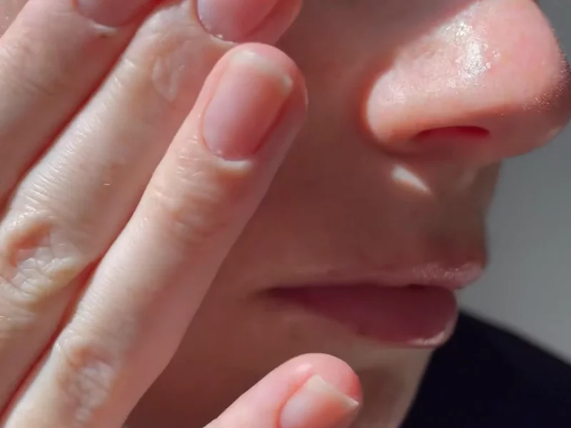 Skincare - Testimonial Ad