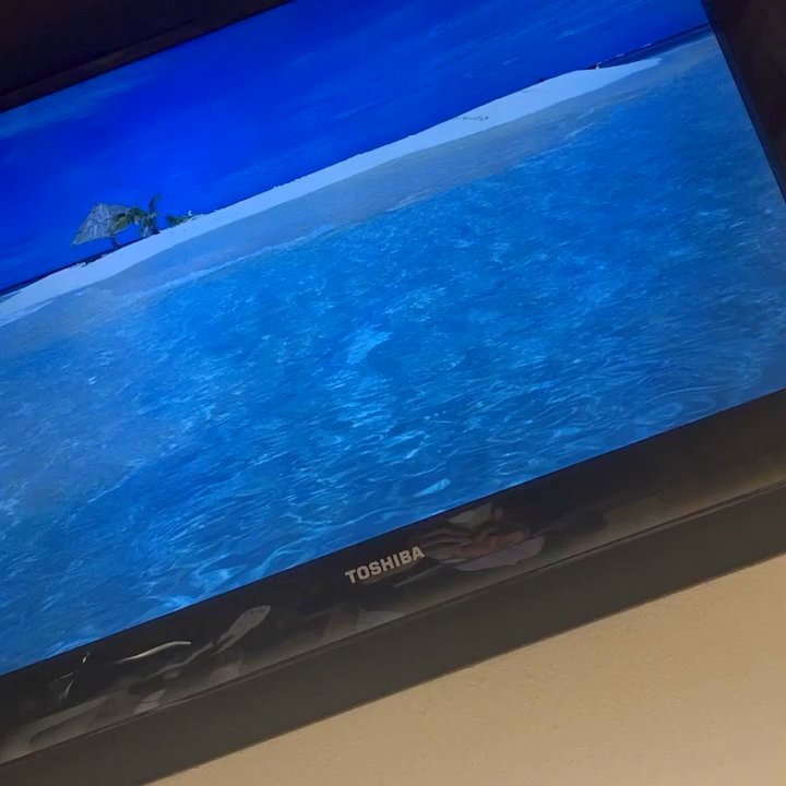 Laura Lawson, DDS - Video on the ceiling! - Cosmetic Dentists Near Me - Albany, California