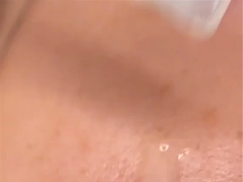 Skincare Video