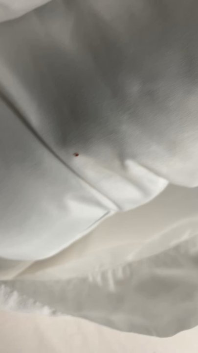 Wyndham Garden Texarkana - Bed bug moving on pillow - Hotels Near Me - Texarkana, Texas