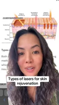 drmonicakieu · Laser basics