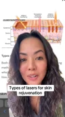 drmonicakieu · Laser basics