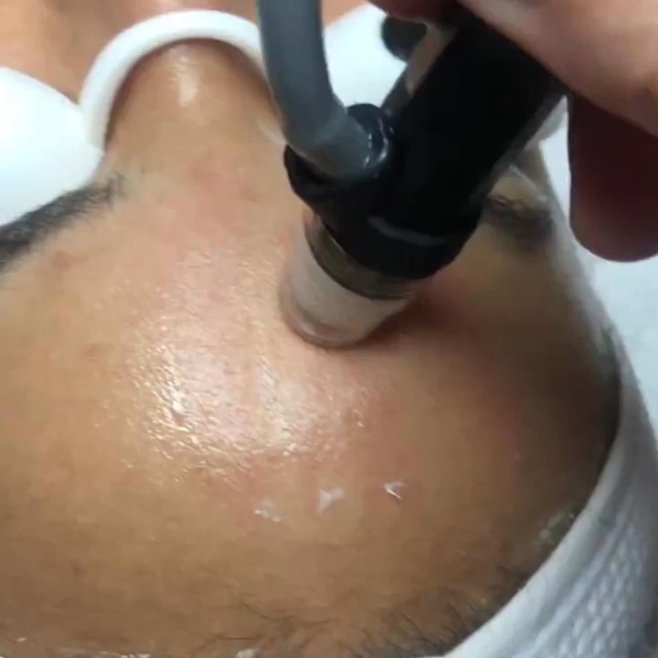 MA Dream Skin - Hydro Facial - Skin Care Near Me - Pasadena, California